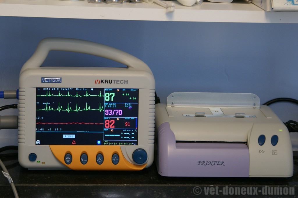 monitoring anesthésie